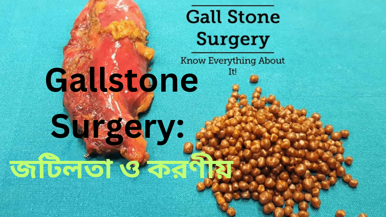 Gallstone is easily treatable with homeopathic medicine