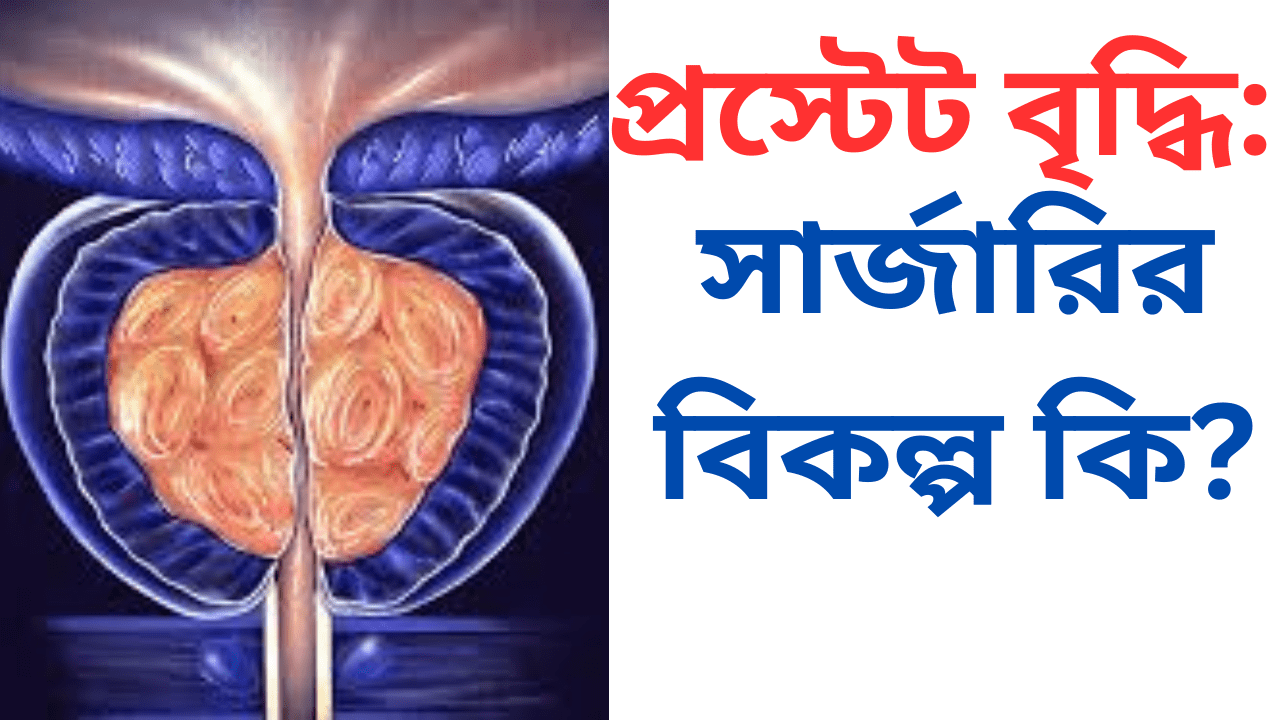 Prostate Gland Enlargement and its Treatment
